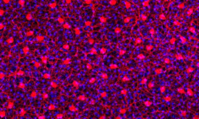 Confocal Micrograph