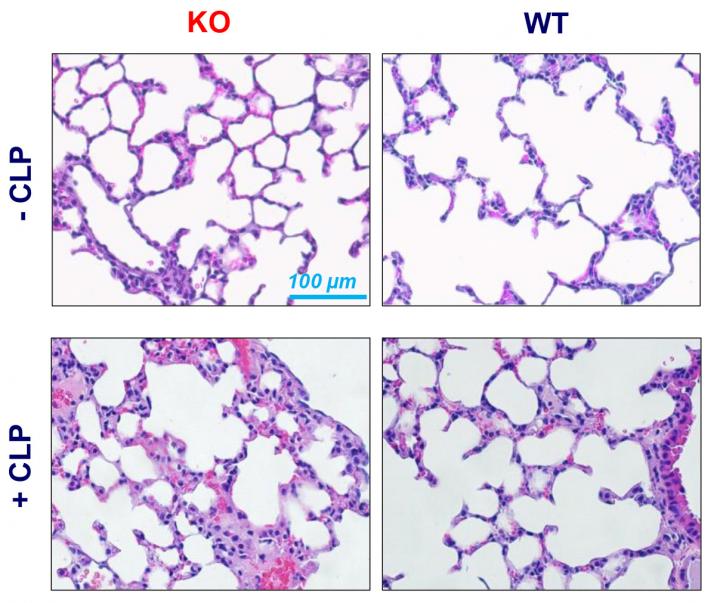 An Antibody Treatment Combats Life-Threatening Sepsis in Rodents (1 of 2)
