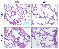 An Antibody Treatment Combats Life-Threatening Sepsis in Rodents (1 of 2)