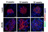 Increase in Macrophages