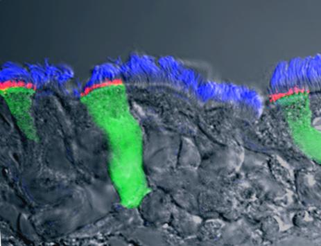 CFTR Protein in Red
