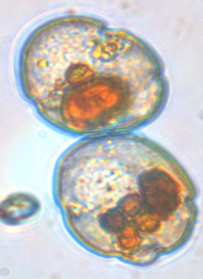 <i>Cochlodinium polykrikoides</i> (1 of 2)