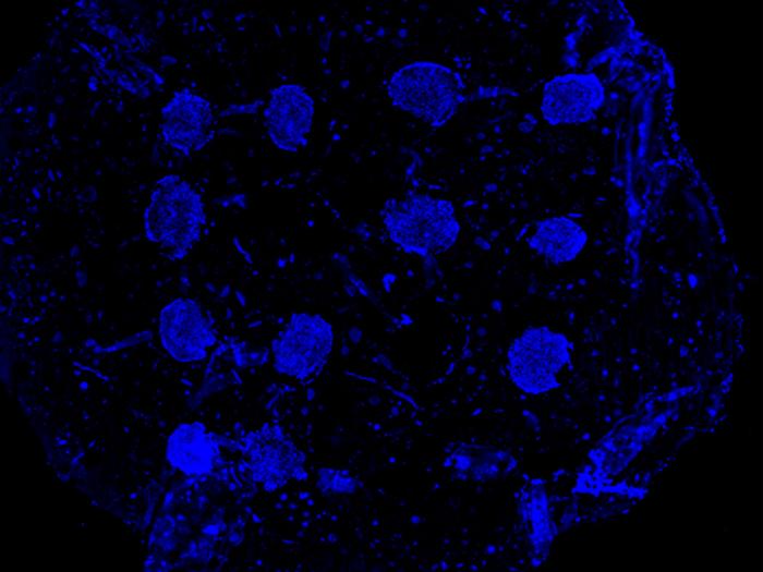 Bone Spheroid Bioprinting