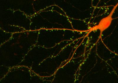 Nerve Cells