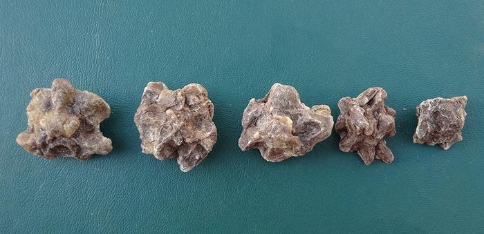 Fossil anaconda vertebrae, which make up the backbone