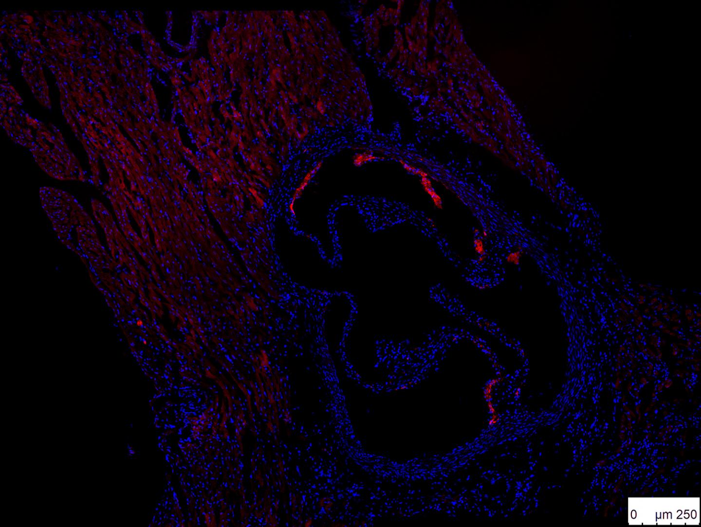 Aortic Root Plaques Wild Type