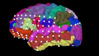 In-Brain Electrodes Study Memory Function