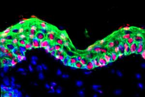 Epidermal stem cells