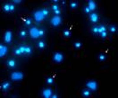 Hippocampal Neurons 
