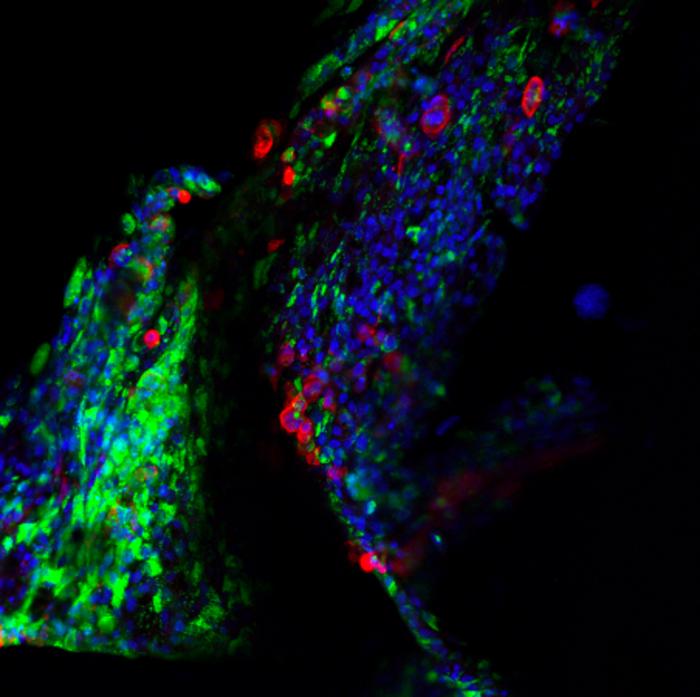 Researchers map key human proteins that power coronavirus replication, pointing to new treatment strategies