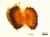 The Signum or 'Vagina Dentata'