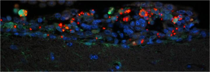 Fluorescent Micrograph of <em>Salmonella</em> in the Brain of a Mouse