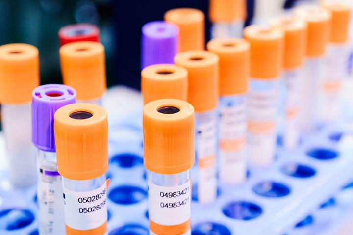 Test Tubes