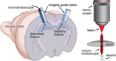 Deepbrain Apparatus