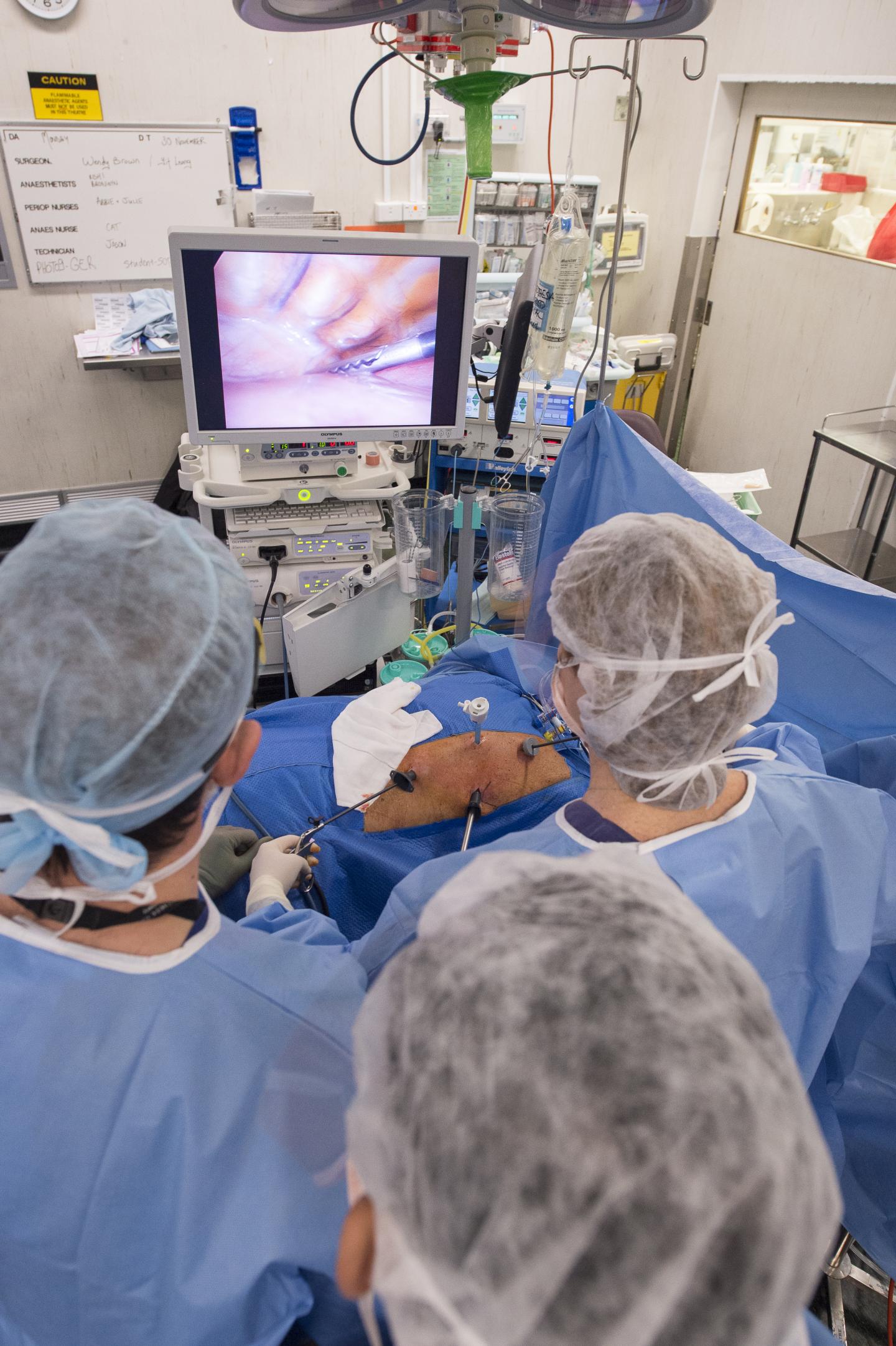 Lap Band Surgery