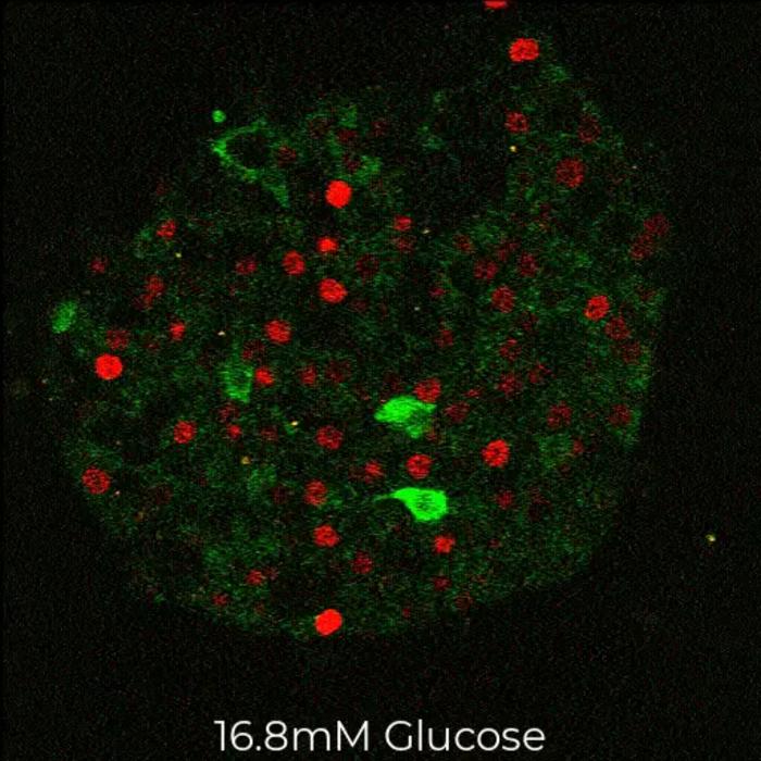 Newly Recognized Pathway Could Protect Diabetics from Hypoglycemia