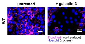 Scripps Research team identifies sugar molecules that trigger placental formation