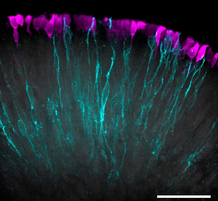 Human retinal organoids
