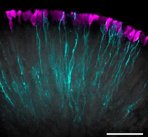 Human retinal organoids