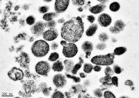 Electron Micrograph of Microparticles Found in the Supernatant of a Freshly Prepared Red Blood Cell 