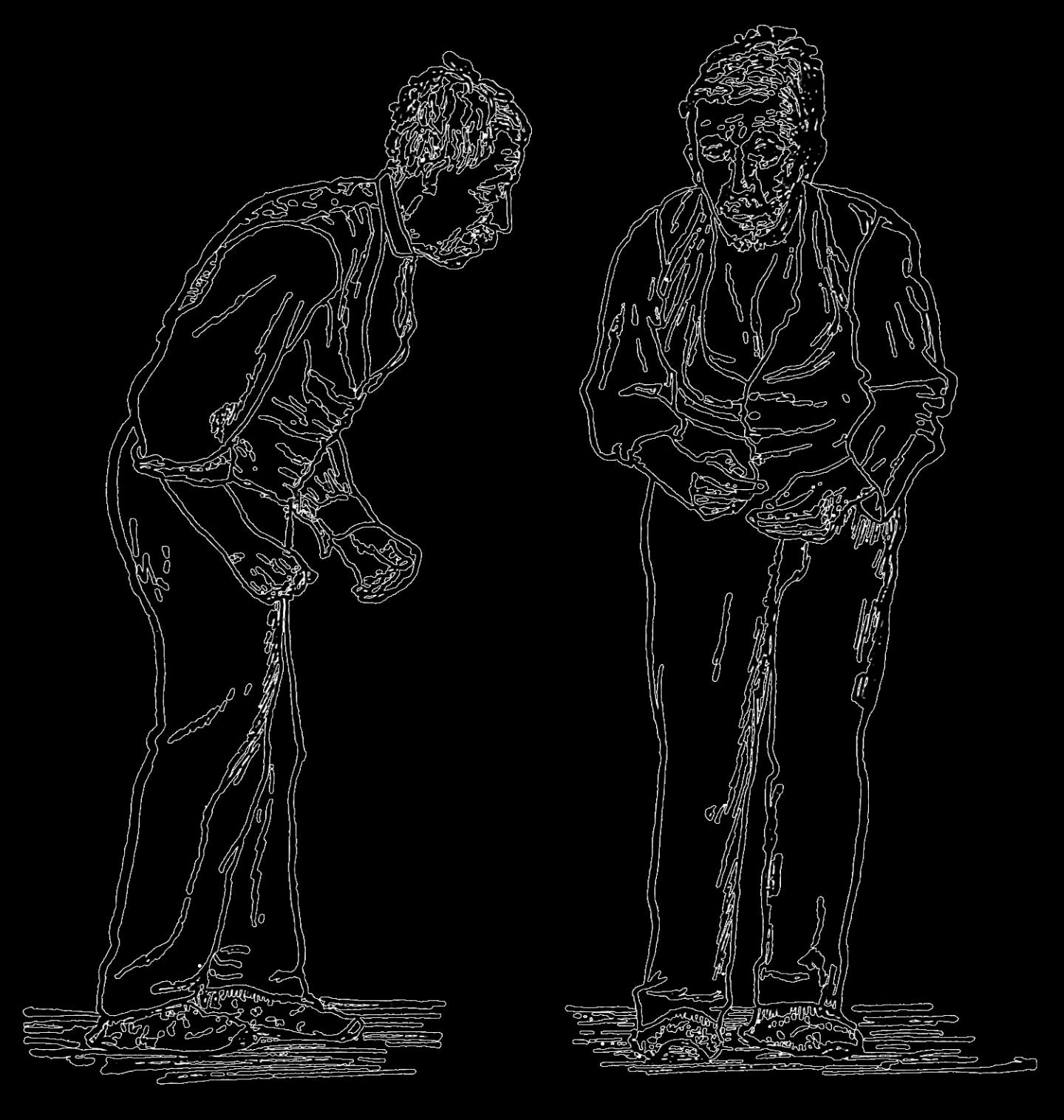 Parkinson's