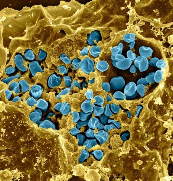 Macrophage Infected with <i>Francisella tularensis</i> Bacteria