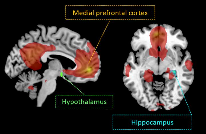 Insulin Activity in the Brain