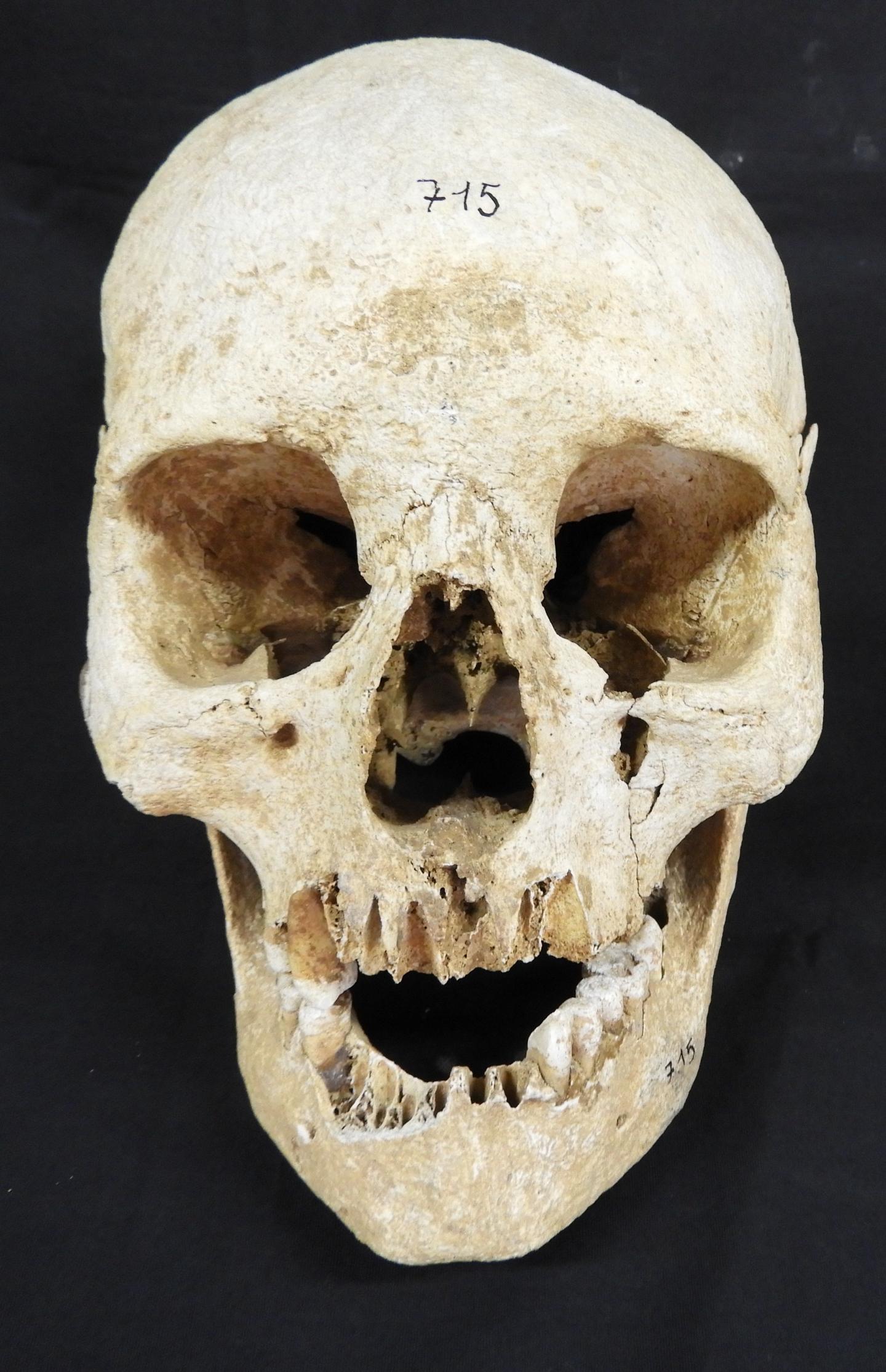 Skull