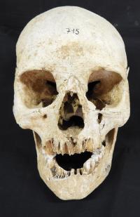 Skull