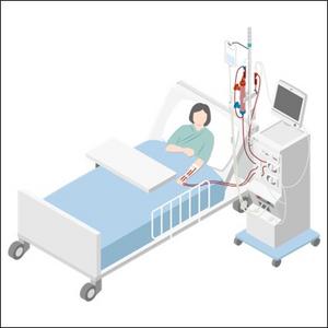 Predictive model for CRRT requirement in AKI after lung transplantation