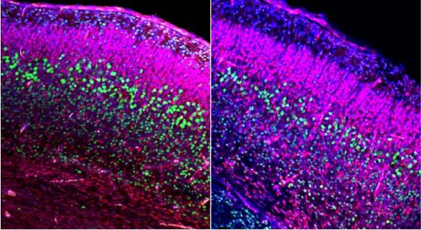 Embryonic Layering of the Brain