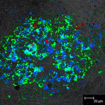Innate Immunity at Work in AIDS Brain Disease