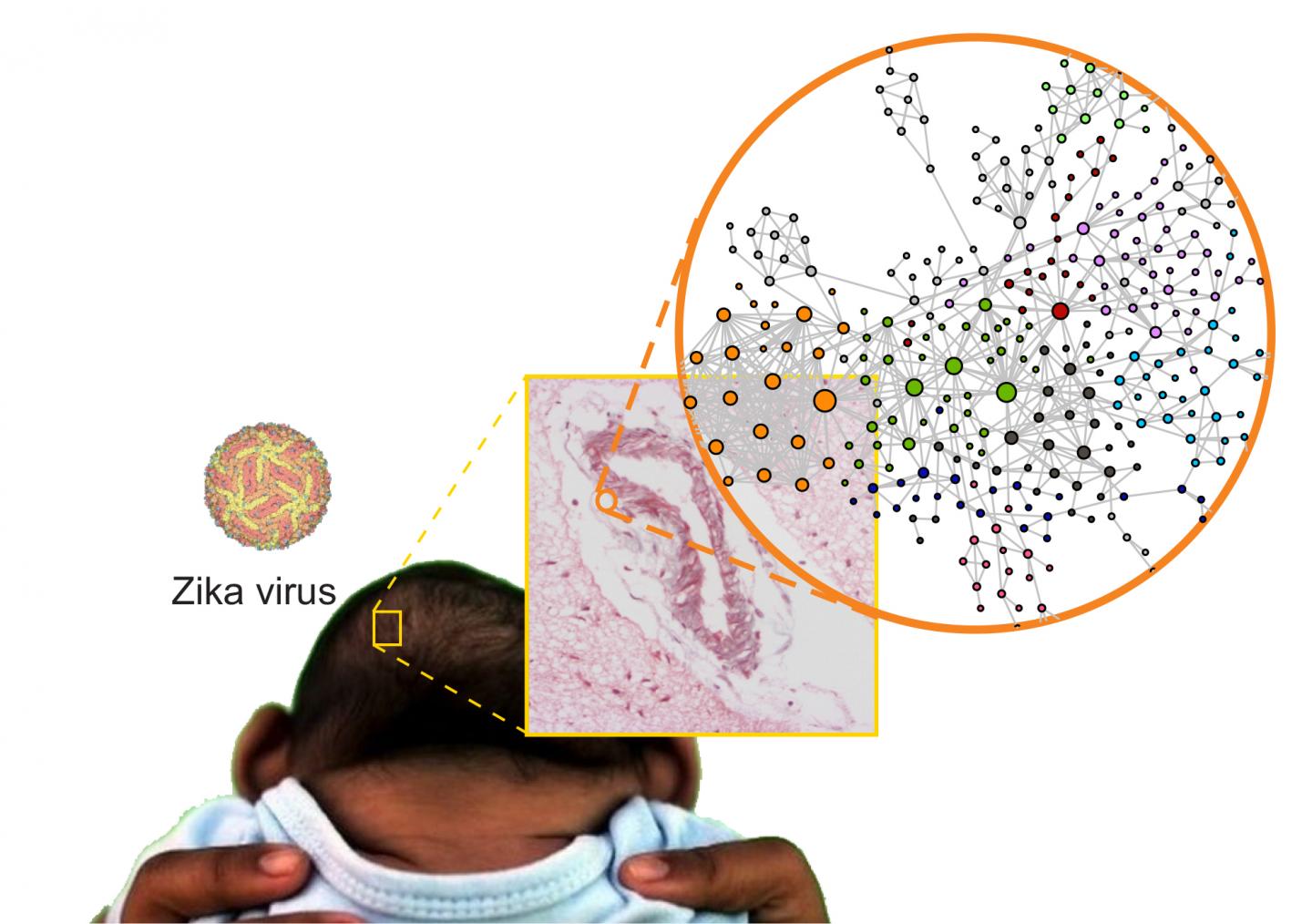 Zika Virus Infection