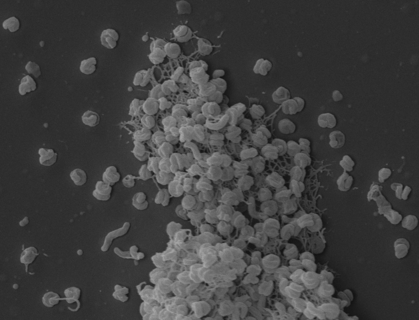 <i>Nitrospira inopinata</i>