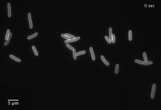 'Shocking' Secret of Cell Wall Growth