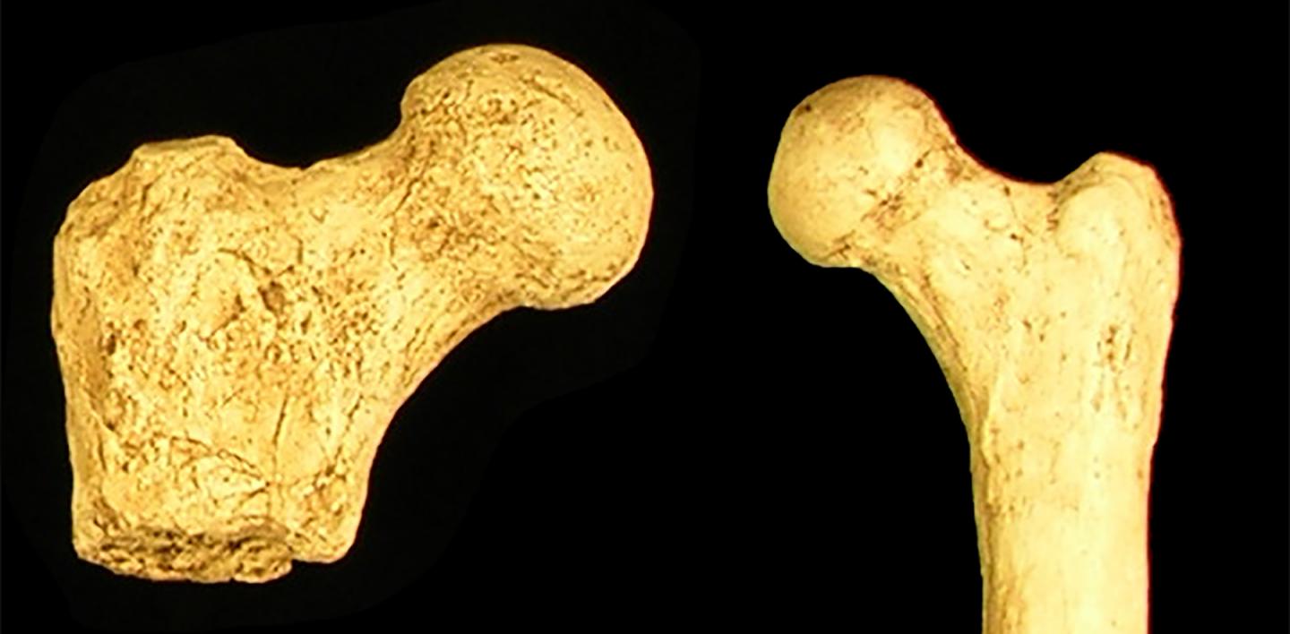 Femur Heads