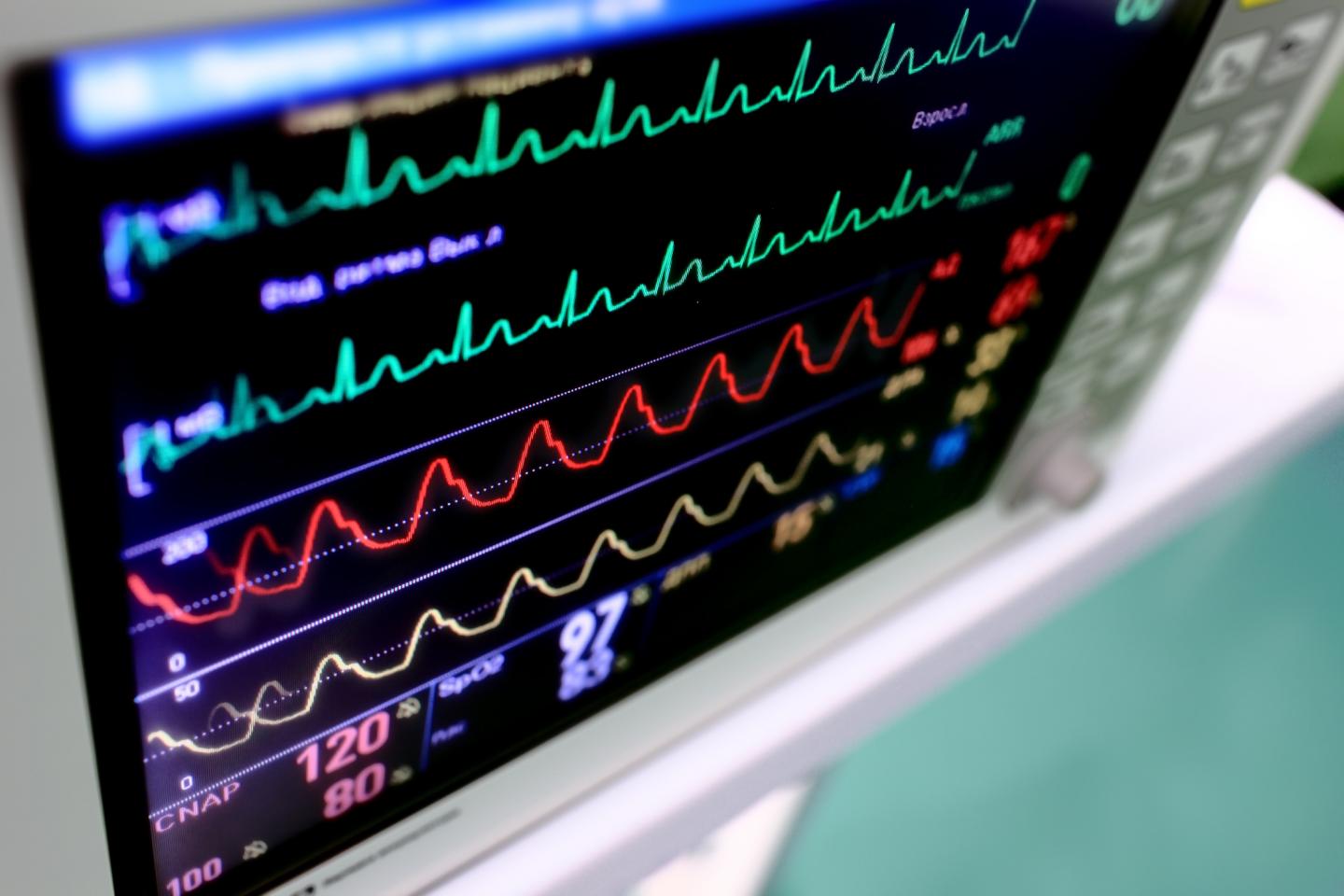 Afib Photo