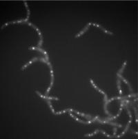 Anthrax Cells (2 of 2)