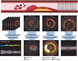 Figure 4Open multimedia modalSchematic of artificial intelligence-driven computational methods in intravascular imaging.