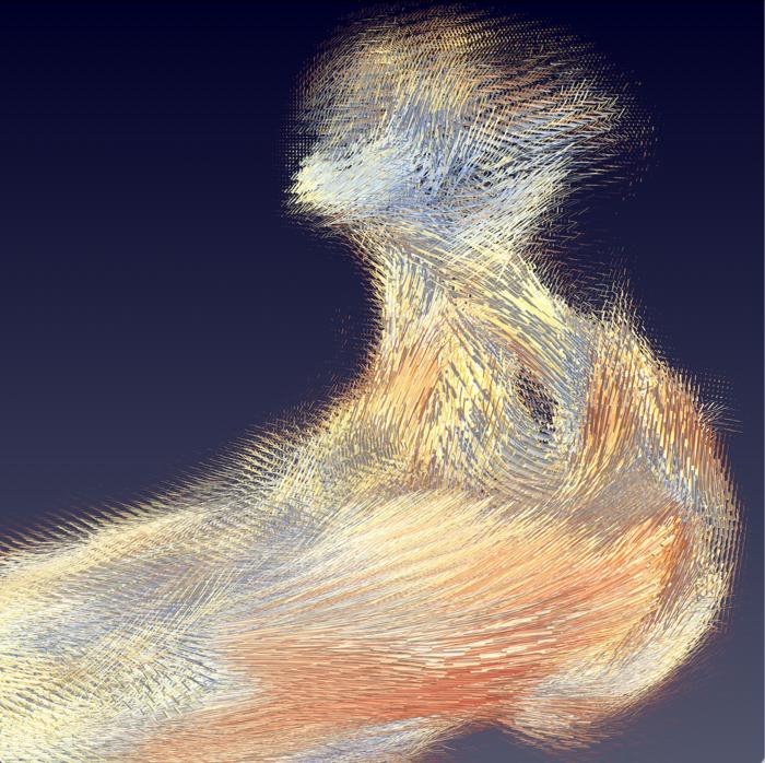 local collagen structures in an ossicle