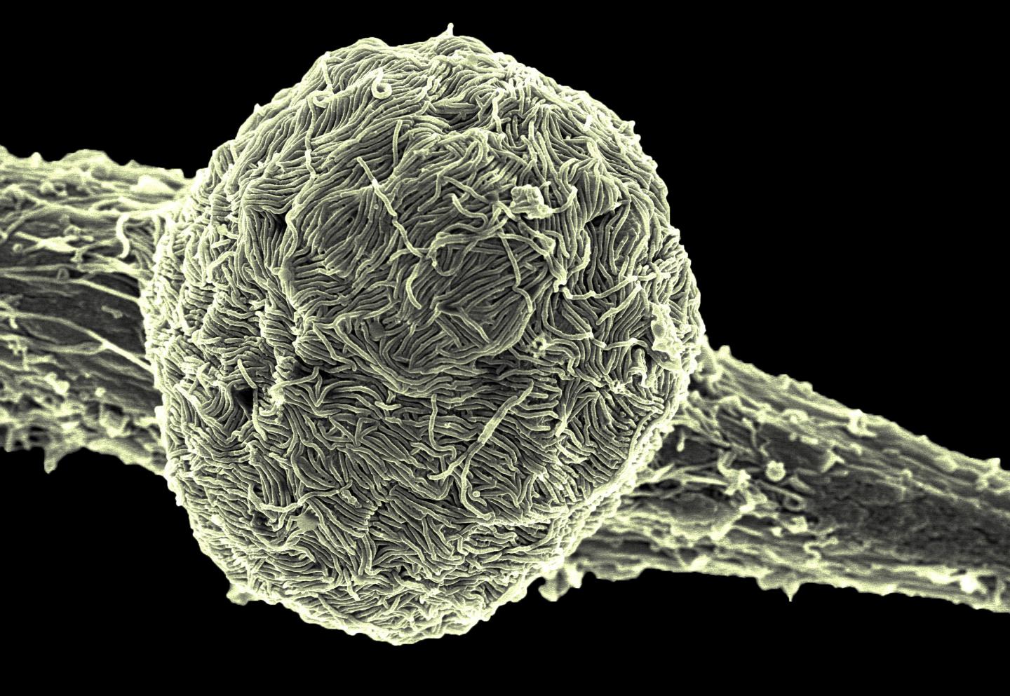 Ebola Virus Makona