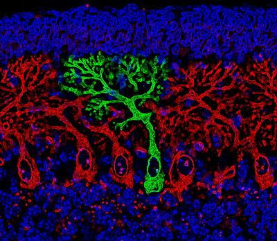 Mouse Cerebellum