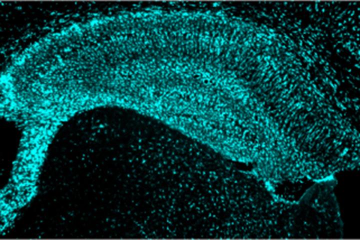 Activated microglia