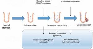 Factors contributing to gastric cancer