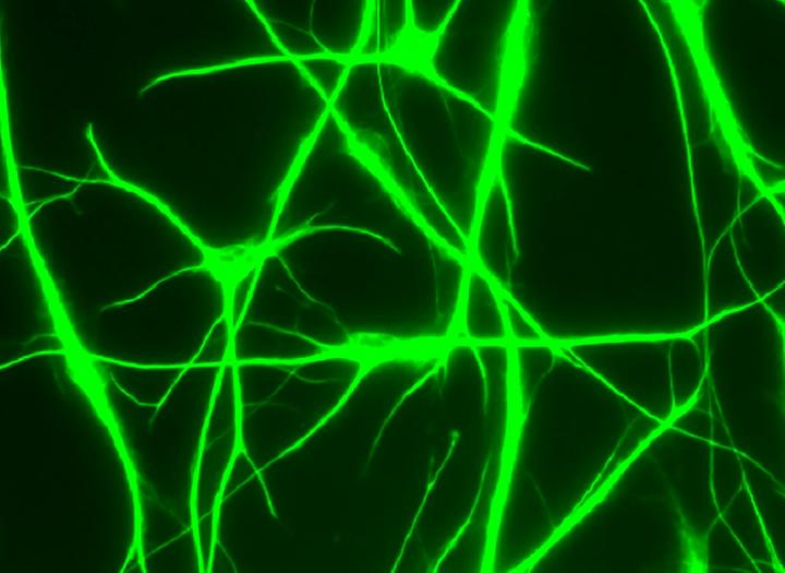 Microscope image of human astrocytes