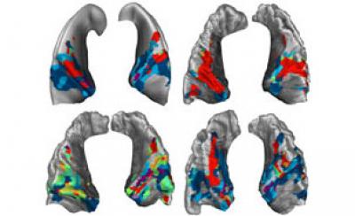 Four Brains React to Music in Same Zone