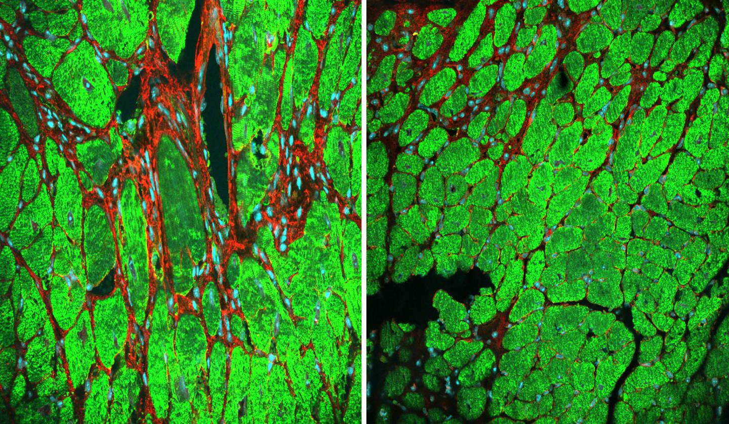 Preserving Heart Function