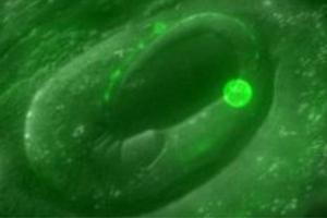 The tiny roundworm C. elegans