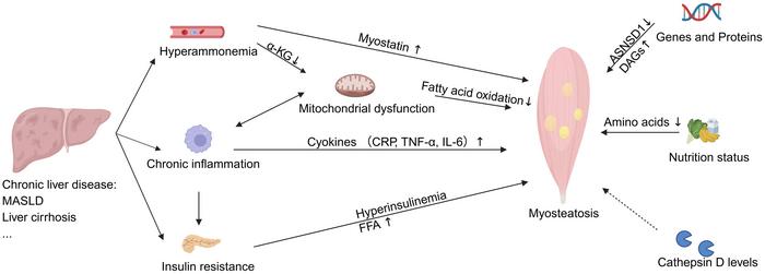 The Clinical Significance of Myosteatosis in Various Liver Diseases