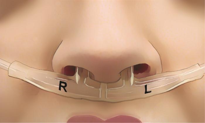 Tubes beneath nose measuring airflow